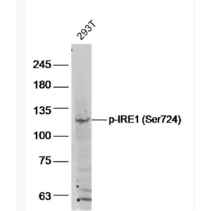 phospho-IRE1 (Ser724) 磷酸化IRE1蛋白抗体