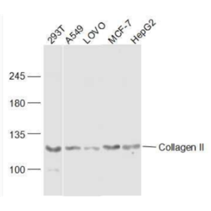 Collagen II Ⅱ型胶原蛋白抗体
