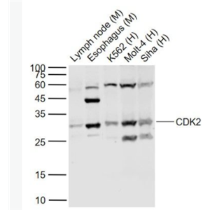 CDK2 周期素依赖性激酶2抗体,CDK2