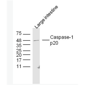 PPP3CC 蛋白磷酸酶3调节亚基C抗体