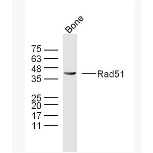 Rad51 Rad51抗体,Rad51