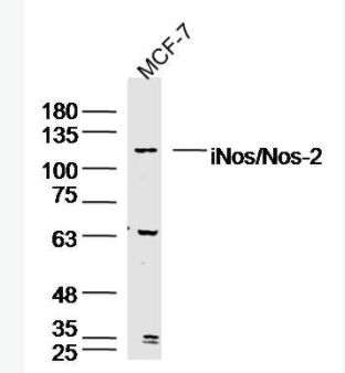 iNos/Nos-2 一氧化氮合成酶-2（诱导型）抗体,iNos/Nos-2