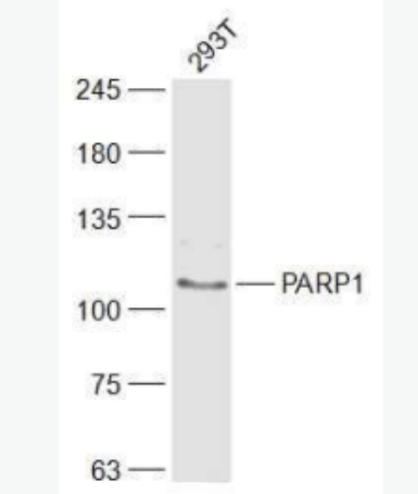 PARP1 多腺苷二磷酸多聚酶抗体/多聚ADP-核糖聚合酶1抗体,PARP1