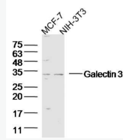 Galectin 3 半乳糖凝集素3抗体,Galectin 3