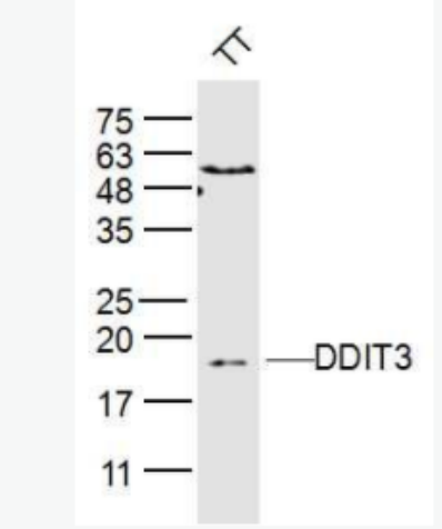 DDIT3 GADD153抗體,DDIT3