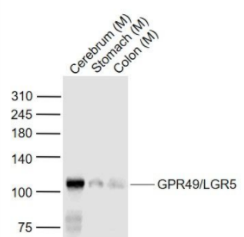 GPR49/LGR5 G蛋白偶联受体49抗体,GPR49/LGR5