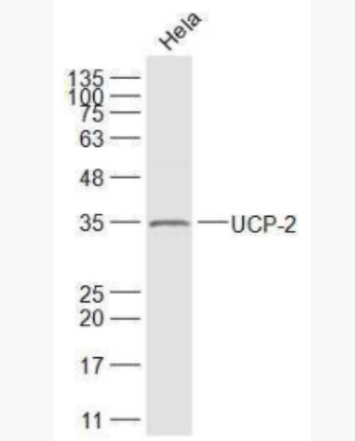 UCP-2 线粒体脱偶连蛋白2抗体,UCP-2