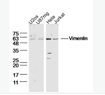 Vimentin 波形蛋白抗體,Vimentin