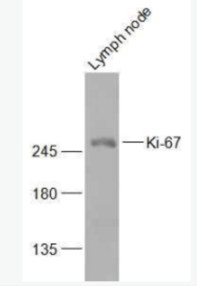 Ki-67 Ki67蛋白抗体,Ki-67