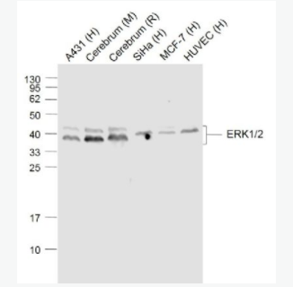 ERK1/2 丝裂原活化蛋白激酶1/2单克隆抗体,ERK1/2