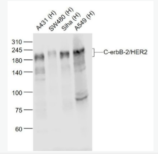 C-erbB-2/HER2 HER2單克隆抗體,C-erbB-2/HER2