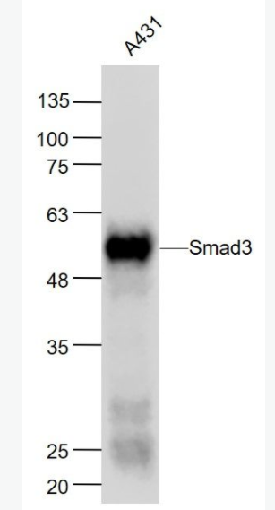 Smad3 細胞信號轉導分子SMAD3單克隆抗體,Smad3