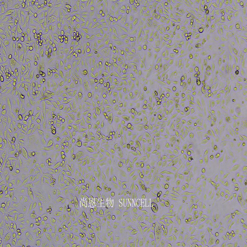 人肾透明细胞癌皮肤转移细胞,CAKI-1