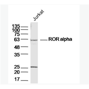 ROR alpha 维甲酸相关孤儿受体α抗体