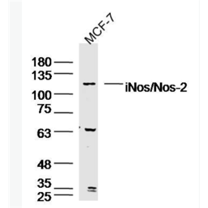 iNos/Nos-2 一氧化氮合成酶-2（诱导型）抗体