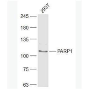 PARP1 多腺苷二磷酸多聚酶抗体/多聚ADP-核糖聚合酶1抗体