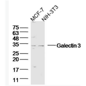 Galectin 3 半乳糖凝集素3抗体