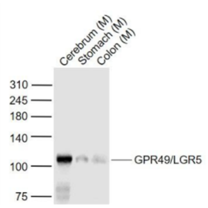 GPR49/LGR5 G蛋白偶联受体49抗体