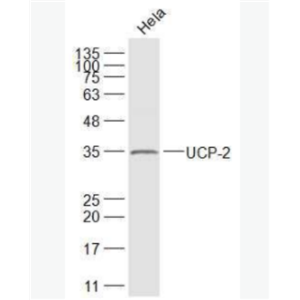 UCP-2  线粒体脱偶连蛋白2抗体