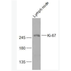 Ki-67 Ki67蛋白抗体,Ki-67