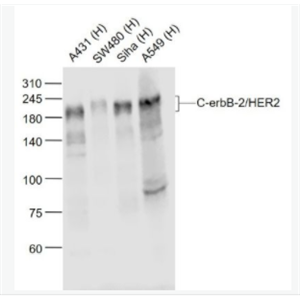 C-erbB-2/HER2 HER2单克隆抗体