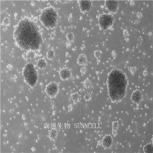 人恶性非霍奇金淋巴瘤患者的自然杀伤细胞,NK-92