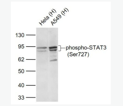 phospho-STAT3 (Ser727) 磷酸化信號轉(zhuǎn)導(dǎo)和轉(zhuǎn)錄激活因子3重組兔單克隆抗體,phospho-STAT3 (Ser727)