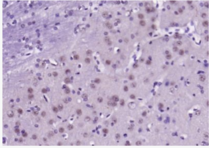 NALP3/CIAS1 細(xì)胞凋亡誘導(dǎo)蛋白NALP3抗體,NALP3/CIAS1