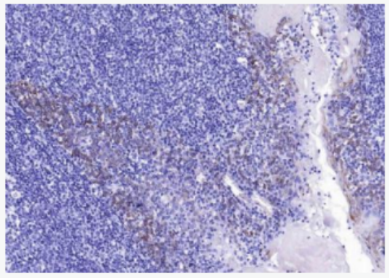 Cytokeratin 14 细胞角蛋白14t重组兔单克隆抗体,Cytokeratin 14