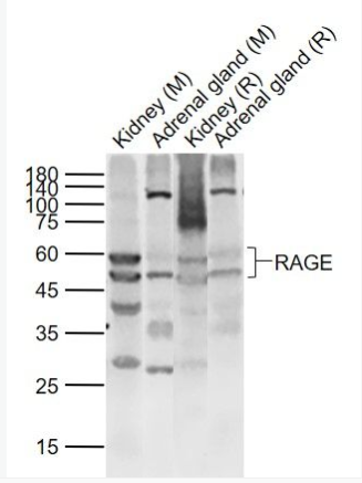 RAGE 晚期糖基化终末产物特异性受体抗体,RAGE