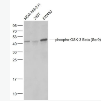 phospho-GSK-3 Beta (Ser9) 磷酸化糖原合酶激酶-3β重组兔单克隆抗体,phospho-GSK-3 Beta (Ser9)