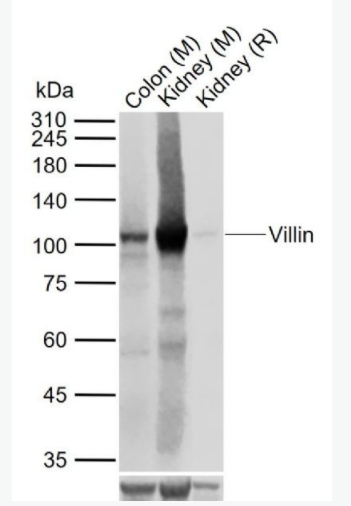 villin 绒毛蛋白重组兔单克隆抗体,villin