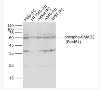 phospho-SMAD2 (Ser464) 磷酸化细胞信号转导分子SMAD2抗体,phospho-SMAD2 (Ser464)