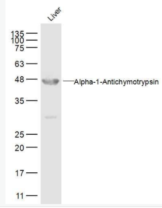 AACT α-1抗胰糜蛋白酶/SERPINA3抗体,AACT