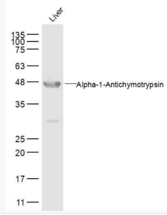 AACT α-1抗胰糜蛋白酶/SERPINA3抗體,AACT
