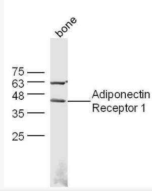 Adiponectin Receptor 1 脂联素受体1抗体,Adiponectin Receptor 1