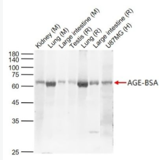 AGEs 晚期糖基化終末產(chǎn)物抗體,AGEs