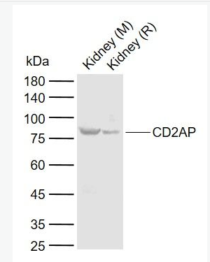 CD2AP 白细胞分化抗原CD2AP抗体,CD2AP