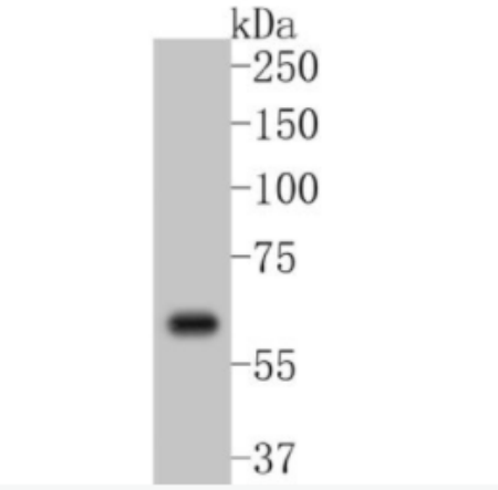 Cyclooxygenase 2 環(huán)氧合酶2重組兔單克隆抗體,Cyclooxygenase 2