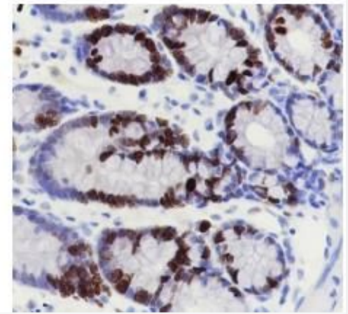 Ki67 Ki67蛋白重組兔單克隆抗體,Ki67