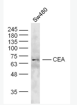 CEA 癌胚抗原抗体,CEA