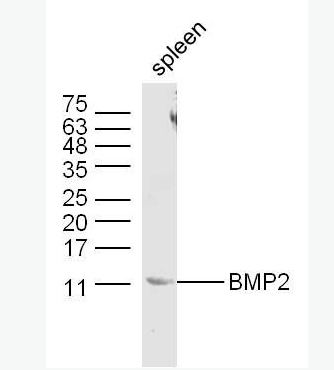 BMP2 骨形态发生蛋白2抗体,BMP2