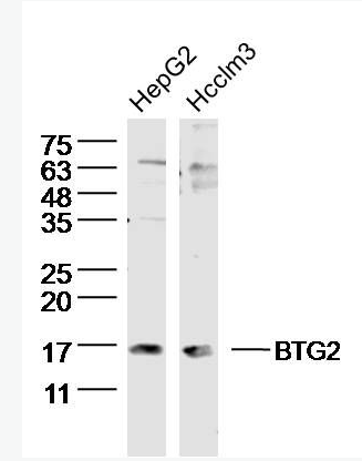 BTG2 B细胞迁移基因2抗体,BTG2