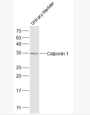 Calponin 1 钙调节蛋白-1抗体,Calponin 1