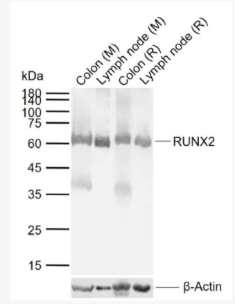RUNX2 核心结合因子α1/成骨特异性转录因子/Cbfα1抗体,RUNX2