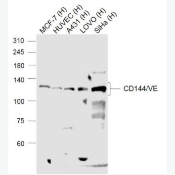 CD144/VE Cadherin 血管内皮钙粘蛋白抗体,CD144/VE Cadherin