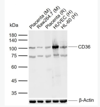 CD36 CD36抗體,CD36