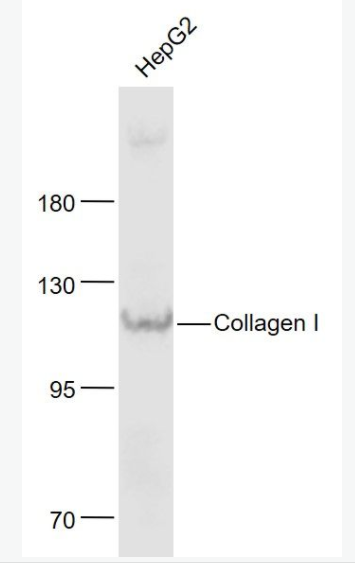 Collagen I I型膠原蛋白抗體,Collagen I