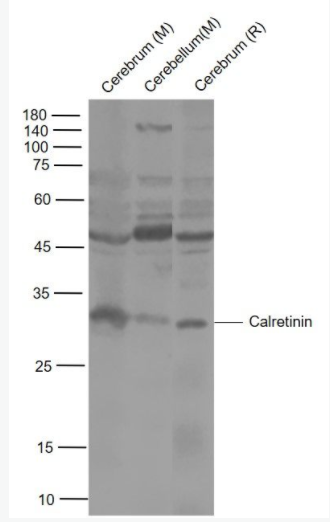 Calretinin 钙结合蛋白抗体,Calretinin