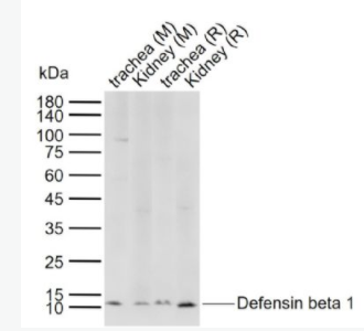 Defensin beta 1 防御素β1/Defensin β1抗体,Defensin beta 1